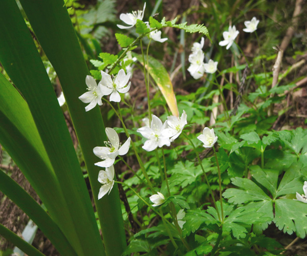 八王子 歯並び、八王子 矯正歯科